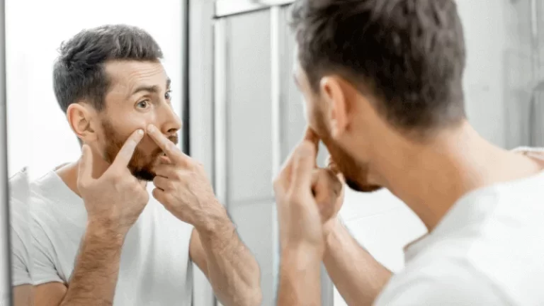 Does Beard Balm Cause Acne And Clog Pores: How to Avoid?